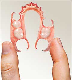 Flexible Denture, flexible teeth, unbreakable teeth, flexible partial denture, flexible teeth