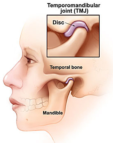 TMJ pain, TMD, Joint pain, Jaw Pain, tooth pain, mouth pain