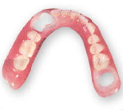 Transitional denture, temporary denture, fake teeth, removable teeth, gasket teeth