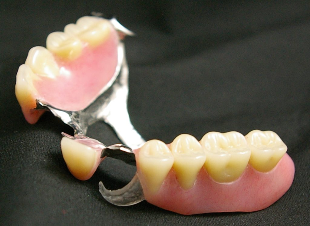 metal partial denture, clear clasp denture, non visible denture, clear denture clasp, removable denture, removable prosthetic teeth
