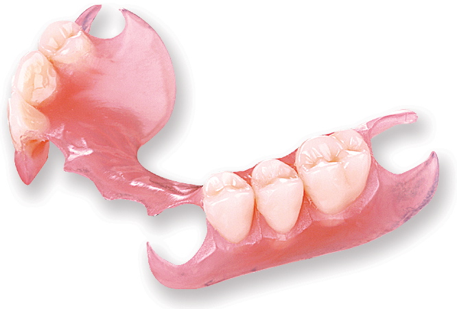 plastic partial, plastic denture, plastic removable teeth, false teeth, no metal teeth, acrylic denture