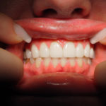 Westwood Dentist, Dentist Westwood, Dr. Philip Aurbach, Old hook Dental
