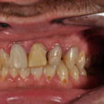 Westwood Dentist, Dentist Westwood, Dr. Philip Aurbach, Old hook Dental