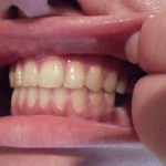 Westwood Dentist, Dentist Westwood, Dr. Philip Aurbach, Old hook Dental