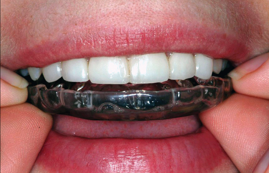 Westwood Dentist, Dentist Westwood, Dr. Philip Aurbach, Old hook Dental
