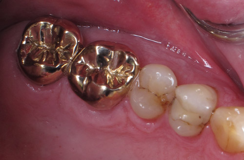 Westwood Dentist, Dentist Westwood, Dr. Philip Aurbach, Old hook Dental