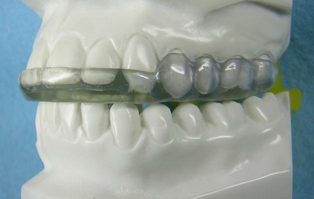 Westwood Dentist, Dentist Westwood, Dr. Philip Aurbach, Old hook Dental