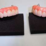 Dental Implant tooth Restoration